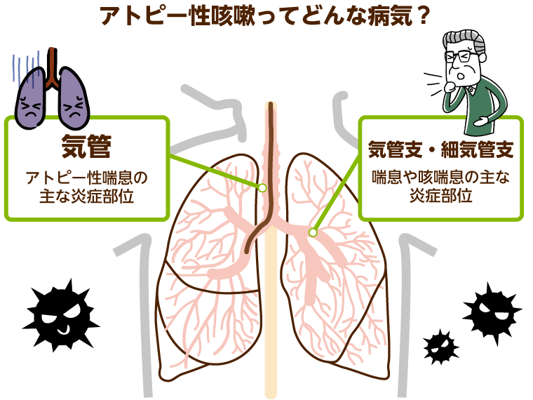 気管支炎のその他の症状