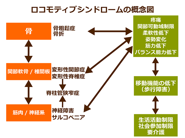 【高齢者に多い】ロコモティブシンドロームとは?原因と予防のポイント|みんなの介護