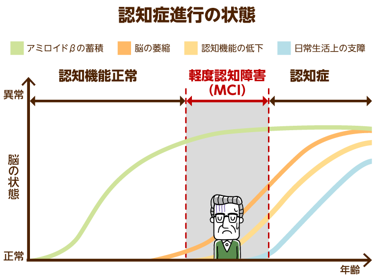 専門家が解説 認知症の初期症状や種類 原因と対応方法 みんなの介護