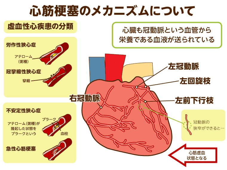 高齢者が気をつけたい 心臓病とは 種類別に原因 症状 予防法を解説 みんなの介護