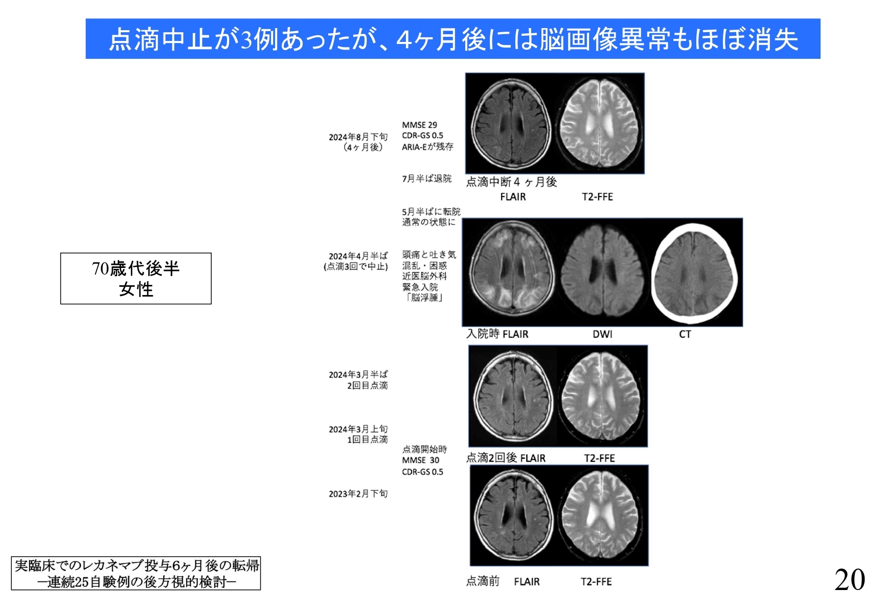アルツハイマー病発症メカニズムと新規診断法・創薬・治療開発 新井 平伊; 他85名 概要)アルツハイマー病発症メカニズムと新規診断法・創薬・治療開発
